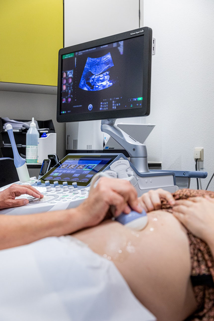 Echografie tijdens de zwangerschap