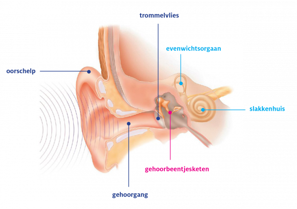 NKO gehoorverlies