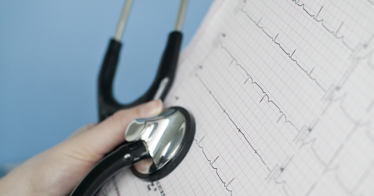 Het elektrocardiogram is een blijver